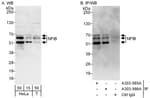Detection of human NFIB by western blot and immunoprecipitation.