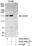 Detection of human DHX57 by western blot of immunoprecipitates.