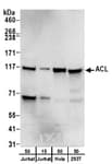 Detection of human ACL by western blot.