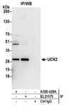 Detection of human UCK2 by western blot of immunoprecipitates.