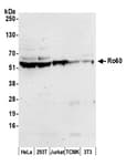 Detection of human and mouse Ro60 by western blot.