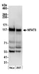 Detection of human NFAT3 by western blot.