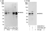 Detection of human and mouse MKK4 by western blot (h&amp;m) and immunoprecipitation (h).