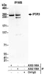 Detection of human IP3R3 by western blot of immunoprecipitates.