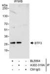 Detection of human BTF3 by western blot of immunoprecipitates.