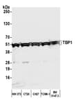 Detection of mouse TBP1 by western blot.