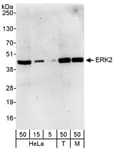 Detection of human and mouse ERK2 by western blot.