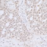 Detection of human CTR9 by immunohistochemistry.