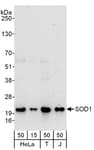 Detection of human SOD1 by western blot.