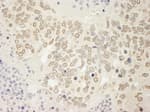 Detection of mouse USP15 by immunohistochemistry.