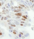 Detection of human ZC3H11A by immunohistochemistry.