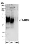 Detection of human SLC26A2 by western blot.