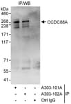 Detection of human CCDC88A by western blot of immunoprecipitates.