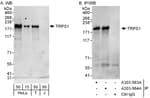 Detection of human TRPS1 by western blot and immunoprecipitation.
