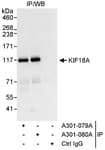Detection of human KIF18A by western blot of immunoprecipitates.
