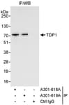 Detection of human TDP1 by western blot of immunoprecipitates.