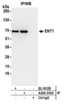Detection of human ENT1 by western blot of immunoprecipitates.
