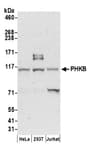 Detection of human PHKB by western blot.