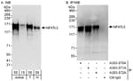 Detection of human NFATc3 by western blot and immunoprecipitation.