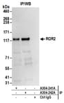 Detection of human ROR2 by western blot of immunoprecipitates.
