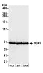 Detection of human DDX5 by western blot.
