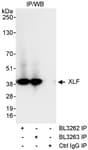 Detection of human XLF by western blot of immunoprecipitates.