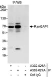 Detection of human RanGAP1 by western blot of immunoprecipitates.