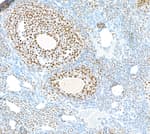 Detection of mouse PARP1 in mouse ovary by IHC.