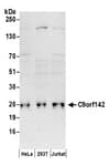 Detection of human C9orf142 by western blot.