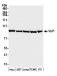 Detection of human and mouse VCP by western blot.