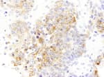 Detection of mouse Drebrin by immunohistochemistry.