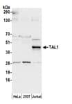 Detection of human TAL1 by western blot.