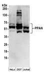 Detection of human PPAN by western blot.