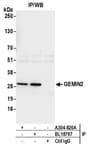 Detection of human GEMIN2 by western blot of immunoprecipitates.