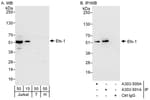 Detection of human Ets-1 by western blot and immunoprecipitation.