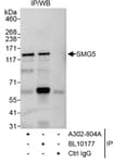 Detection of human SMG5 by western blot of immunoprecipitates.