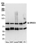 Detection of human and mouse ERCC3 by western blot.
