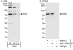 Detection of human RED by western blot and immunoprecipitation.
