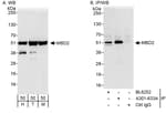 Detection of human and mouse MBD2 by western blot (h&amp;m) and immunoprecipitation (h).
