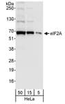 Detection of human eIF2A by western blot.