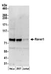 Detection of human Raver1 by western blot.