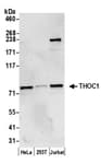Detection of human THOC1 by western blot.