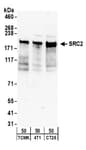 Detection of mouse NCOA2/ SRC2 by western blot.