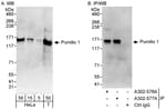Detection of human Pumilio 1 by western blot and immunoprecipitation.