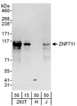 Detection of human ZNF711 by western blot.