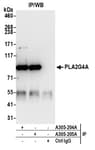 Detection of human PLA2G4A by western blot of immunoprecipitates.