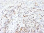 Detection of human STAT5a by immunohistochemistry.