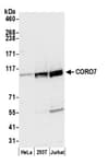 Detection of human CORO7 by western blot.