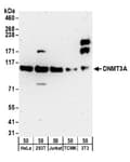 Detection of human and mouse DNMT3A by western blot.