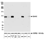 Detection of human EphA2 by western blot.